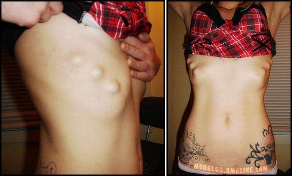Body Modifications 87